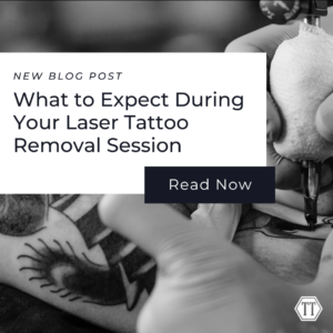 Laser Removal Syracuse