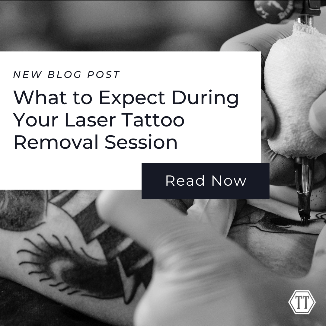 Tattoo Removal Is laser tattoo removal painful  Clearskin Pune